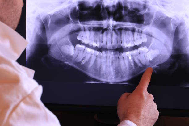 Best Emergency Tooth Extraction in Burgaw, NC